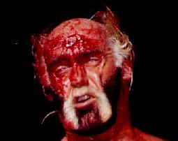 Hogan Is Bleeding Heavily